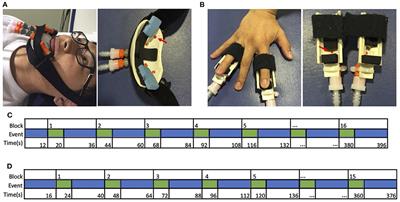 Changes in primary somatosensory cortex following allogeneic hand transplantation or autogenic hand replantation